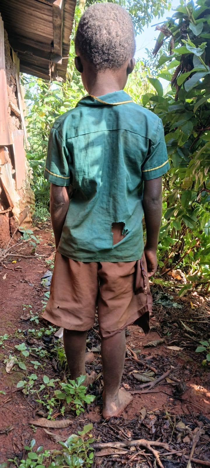 Before: one of the boys, photographed from behind, barefoot in a torn school shirt and ripped shorts.